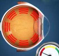 Глазное давление норма. Сиптомы лечение нарушений глазного давления. Снижение