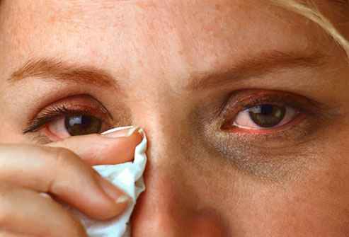 Чем снимать макияж с глаз при аллергии