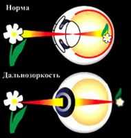 Гимнастика Поля Брэгга. Гиперметропия. Гипертоническая болезнь и глаз Е.А. Егоров.