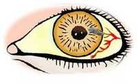 Осложнения при пломбировании склеры. Осложнения проникающих ранений глаза. Осмотр глазного яблока.