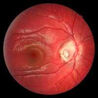 Ямка диска зрительного нерва. Японские витамины для глаз. Яркость и острота зрения.