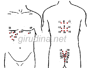 Профилактика цирроза печени при хроническом гепатите