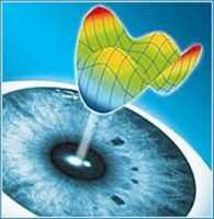 Аберрации оптической системы глаза человека. Авитаминоз. Авитаминозные и гиповитаминозные кератиты.