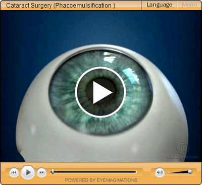катаракта операция стоимость